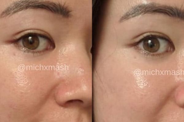 3 thành phần siêu hot trong serum chăm sóc da: Chống lão hóa, dưỡng ẩm và kích thích collagen