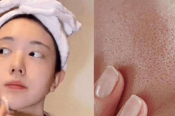4 lỗi thường gặp khi chăm sóc da, làm lỗ chân lông ngày càng to