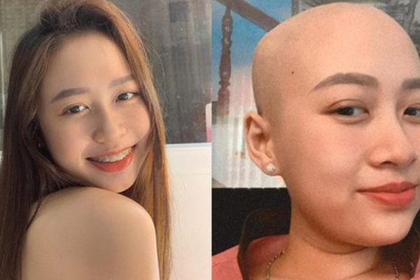 Cô gái 2000 phát hiện ung thư sau ngày cưới: Chồng làm điều đặc biệt