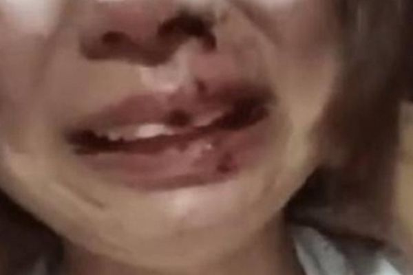 Cô gái bị đánh dã man vì đăng ảnh ly hôn lên mạng