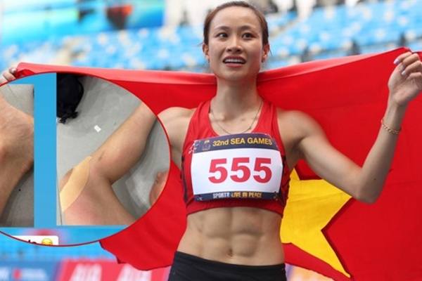 Ngắm chân trầy xước của Hotgirl 6 múi vô địch điền kinh SEA Games 32