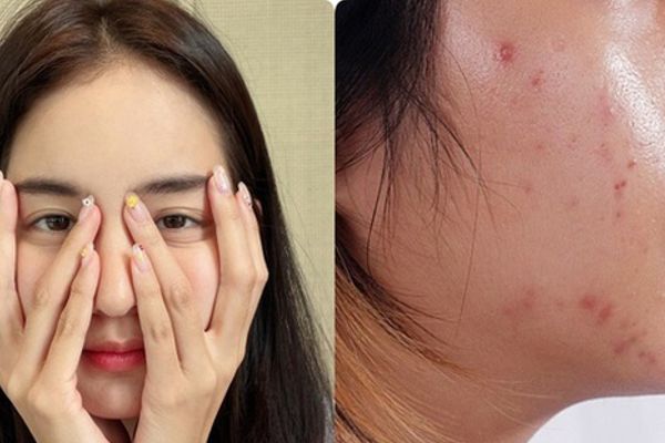 Tại sao chúng ta lão hóa nhanh hơn các bà, các mẹ?