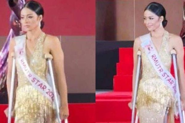 Thí sinh hoa hậu cụt chân rực rỡ trên sàn catwalk